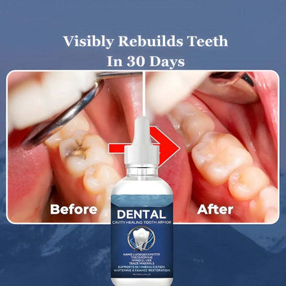 Heroiy™ Advanced Enamel Repair & Whitening Kit (Includes Free LED Mirror)-YH
