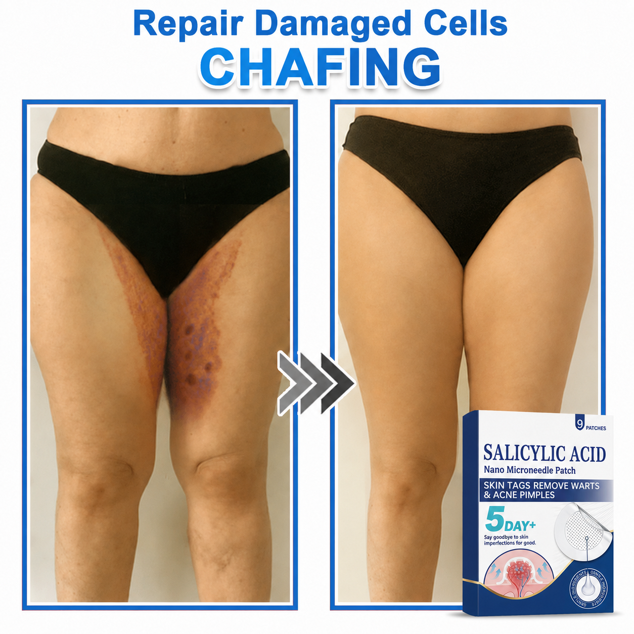 🏆 Heroiy® 2-in-1 Microneedle & Hydrocolloid Patch | Raised Moles,Acne, Flat Warts & Skin Tags Remover | Improves Wrinkles, Scars & Blemishes | Invisible Pimple Patches for Face & Body-ANN