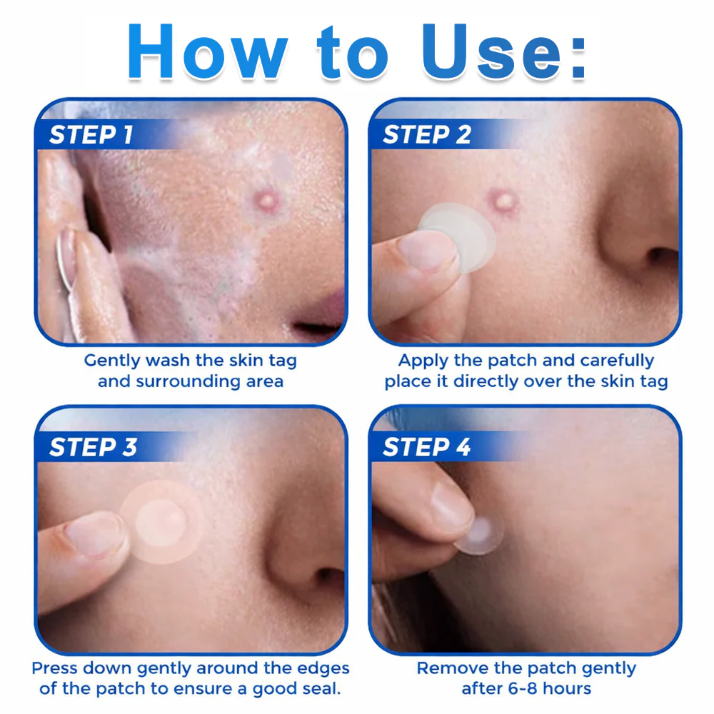 🏆 Heroiy® 2-in-1 Microneedle & Hydrocolloid Patch | Raised Moles,Acne, Flat Warts & Skin Tags Remover | Improves Wrinkles, Scars & Blemishes | Invisible Pimple Patches for Face & Body-ANN