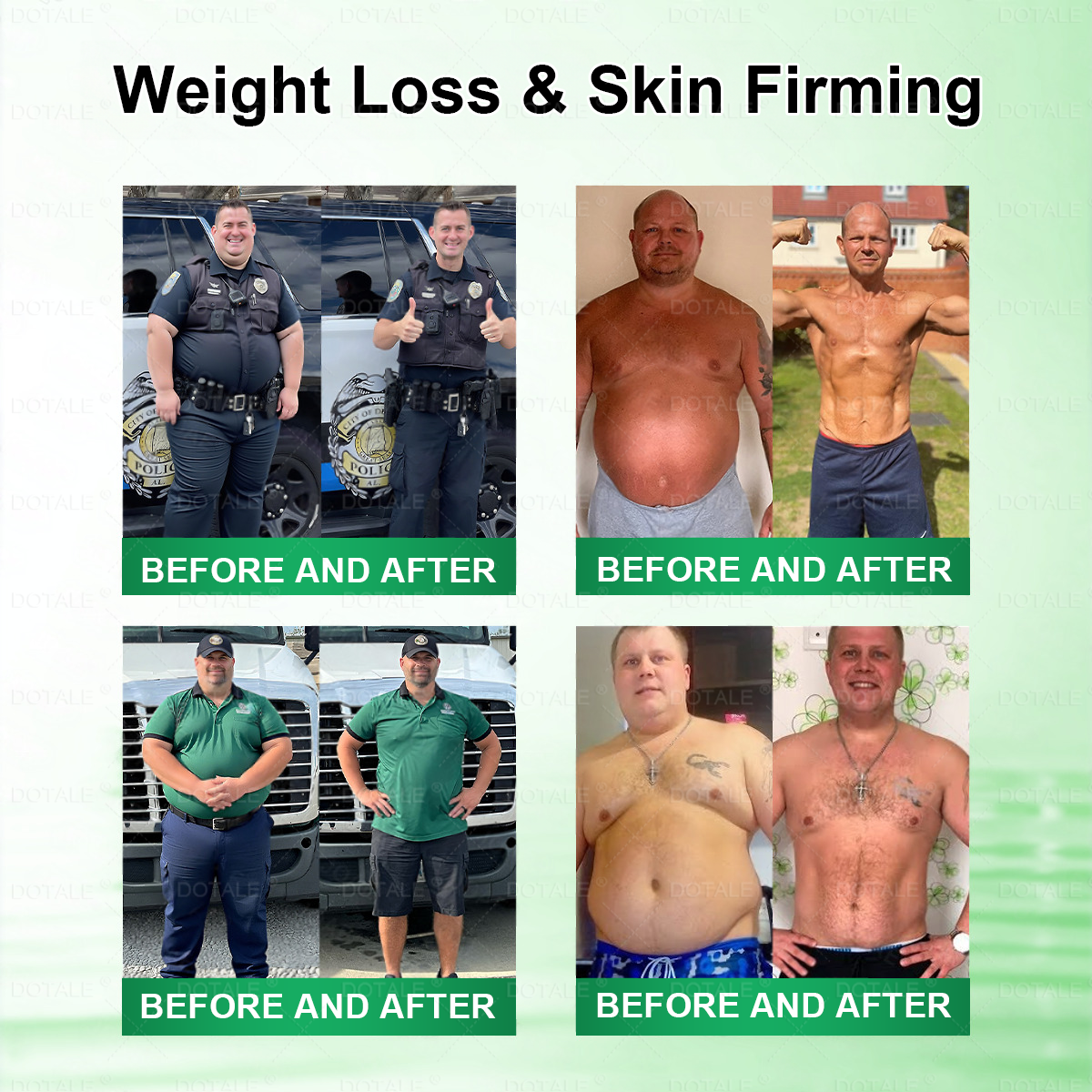 𝐇𝐞𝐫𝐨𝐢𝐲® 𝑴𝒆𝒕𝒂𝒃𝒐𝒍𝒊𝒄 𝑵𝒂𝒏𝒐 𝑴𝒊𝒄𝒓𝒐𝒏𝒆𝒆𝒅𝒍𝒆 𝑷𝒂𝒕𝒄𝒉🎄(𝐉𝐮𝐬𝐭 𝐨𝐧𝐜𝐞 𝐚 𝐝𝐚𝐲, 𝐯𝐢𝐬𝐢𝐛𝐥𝐞 𝐜𝐡𝐚𝐧𝐠𝐞𝐬 𝐢𝐧 𝟕 𝐝𝐚𝐲𝐬）𝘽𝙚𝙧𝙗𝙚𝙧𝙞𝙣𝙚 + 𝙈𝙤𝙧𝙞𝙣𝙜𝙖 𝙁𝙤𝙧𝙢𝙪𝙡𝙖 ✅ 𝐅𝐨𝐫 𝐨𝐛𝐞𝐬𝐢𝐭𝐲, 𝗟𝗼𝗼𝘀𝗲 𝘀𝗸𝗶𝗻,𝐝𝐢𝐚𝐛𝐞𝐭𝐞𝐬, 𝐬𝐥𝐞𝐞𝐩 𝐚𝐩𝐧𝐞𝐚, 𝐣𝐨𝐢𝐧𝐭 𝐢𝐬𝐬𝐮𝐞𝐬, 𝐚𝐧𝐝 𝐦𝐨𝐫𝐞 💥💥-JX