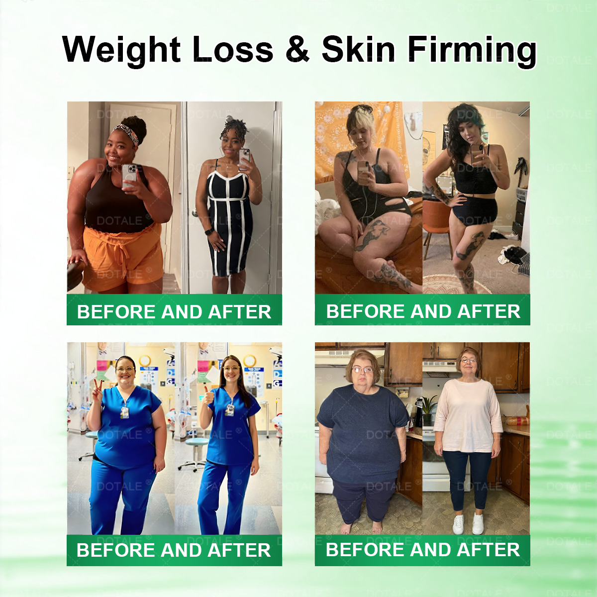 𝐇𝐞𝐫𝐨𝐢𝐲® 𝑴𝒆𝒕𝒂𝒃𝒐𝒍𝒊𝒄 𝑵𝒂𝒏𝒐 𝑴𝒊𝒄𝒓𝒐𝒏𝒆𝒆𝒅𝒍𝒆 𝑷𝒂𝒕𝒄𝒉🎄(𝐉𝐮𝐬𝐭 𝐨𝐧𝐜𝐞 𝐚 𝐝𝐚𝐲, 𝐯𝐢𝐬𝐢𝐛𝐥𝐞 𝐜𝐡𝐚𝐧𝐠𝐞𝐬 𝐢𝐧 𝟕 𝐝𝐚𝐲𝐬）𝘽𝙚𝙧𝙗𝙚𝙧𝙞𝙣𝙚 + 𝙈𝙤𝙧𝙞𝙣𝙜𝙖 𝙁𝙤𝙧𝙢𝙪𝙡𝙖 ✅ 𝐅𝐨𝐫 𝐨𝐛𝐞𝐬𝐢𝐭𝐲, 𝗟𝗼𝗼𝘀𝗲 𝘀𝗸𝗶𝗻,𝐝𝐢𝐚𝐛𝐞𝐭𝐞𝐬, 𝐬𝐥𝐞𝐞𝐩 𝐚𝐩𝐧𝐞𝐚, 𝐣𝐨𝐢𝐧𝐭 𝐢𝐬𝐬𝐮𝐞𝐬, 𝐚𝐧𝐝 𝐦𝐨𝐫𝐞 💥💥-JX