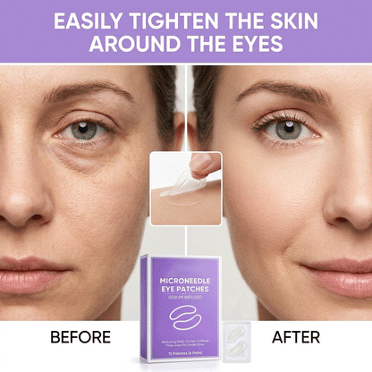 👁️👁️👁️ Upgraded New Packaging WAKE UP LOOKING YEARS YOUNGER Hyaluronic Acid Microneedle Eye Mask-ZGD