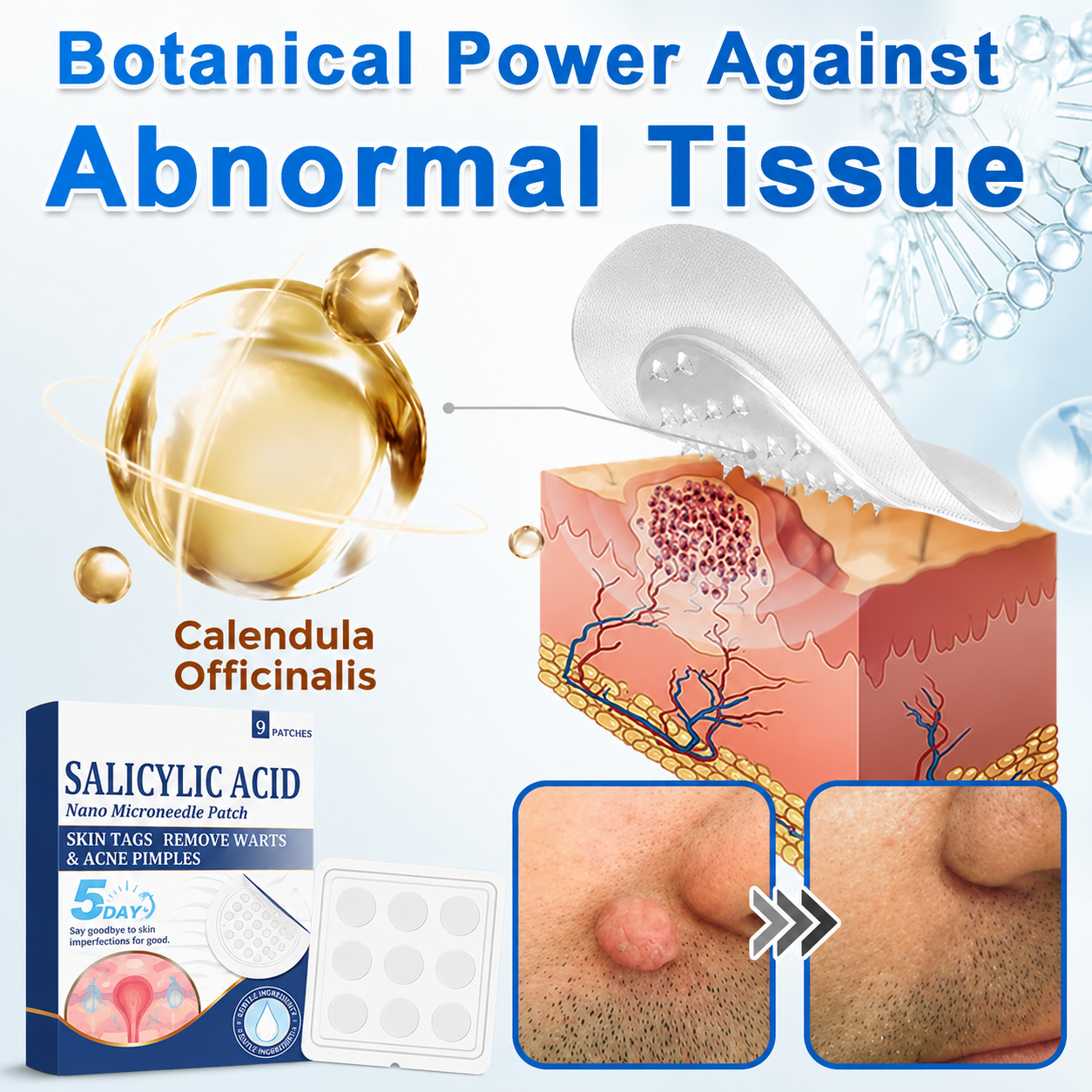 🏆 Heroiy® 2-in-1 Microneedle & Hydrocolloid Patch | Raised Moles,Acne, Flat Warts & Skin Tags Remover | Improves Wrinkles, Scars & Blemishes | Invisible Pimple Patches for Face & Body-ANN