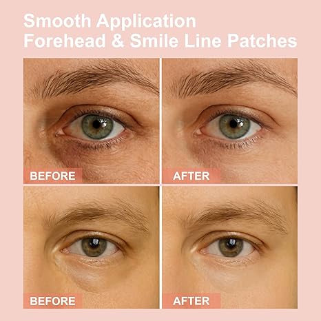 👁️👁️👁️ Upgraded New Packaging WAKE UP LOOKING YEARS YOUNGER Hyaluronic Acid Microneedle Eye Mask-ZGD