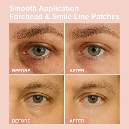 👁️👁️👁️ Upgraded New Packaging WAKE UP LOOKING YEARS YOUNGER Hyaluronic Acid Microneedle Eye Mask-ZGD