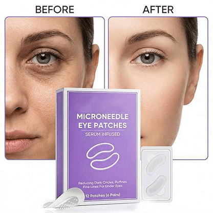 👁️👁️👁️ Upgraded New Packaging WAKE UP LOOKING YEARS YOUNGER Hyaluronic Acid Microneedle Eye Mask-ZGD