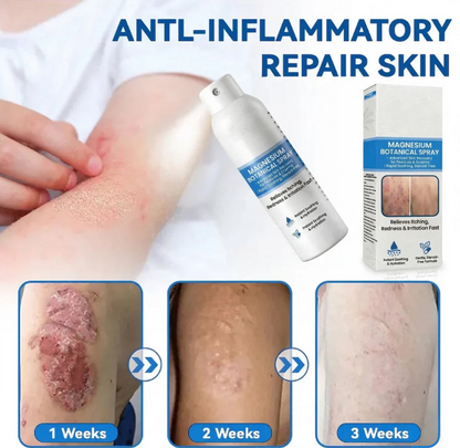 🔥Heroiy® Magnesium Botanical Spray – Advanced Skin Recovery for Psoriasis & Eczema | Rapid Soothing, Steroid-Free-YH