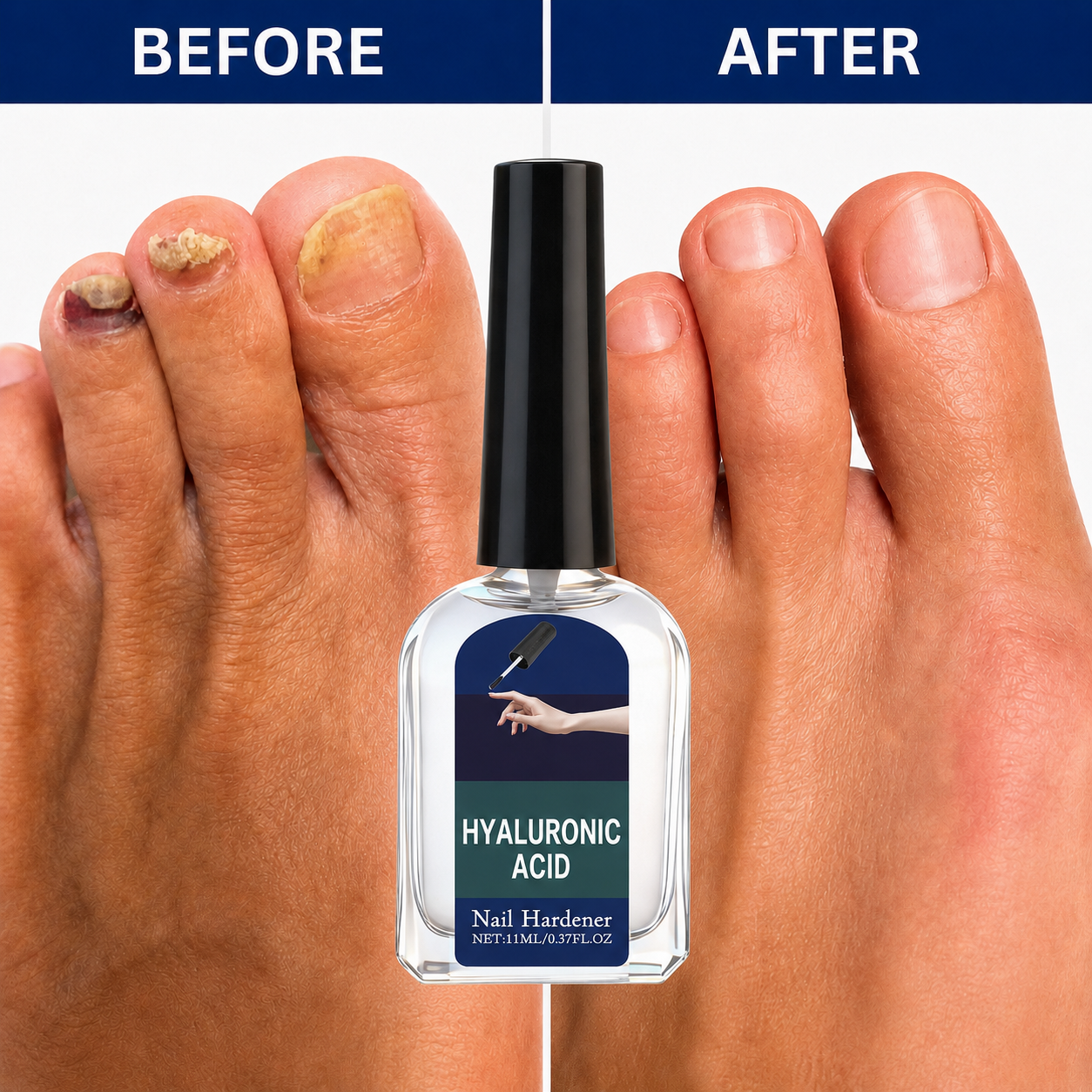 Clear Fungus Nails & Restore Healthy Clear Nails in Just 14 Days!-JX