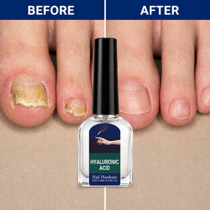 Clear Fungus Nails & Restore Healthy Clear Nails in Just 14 Days!-JX
