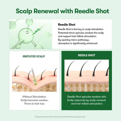 PDRN Microneedle Scalp Serum Brush – Hair Thickening & Root Activating Treatment for Fuller, Healthier-Looking Hair-YH