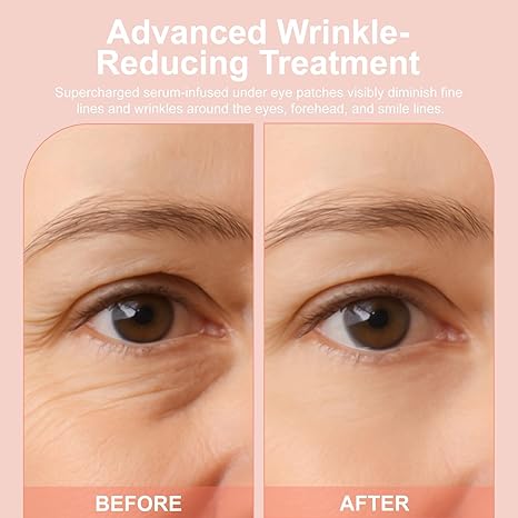 👁️👁️👁️ Upgraded New Packaging WAKE UP LOOKING YEARS YOUNGER Hyaluronic Acid Microneedle Eye Mask-ZGD