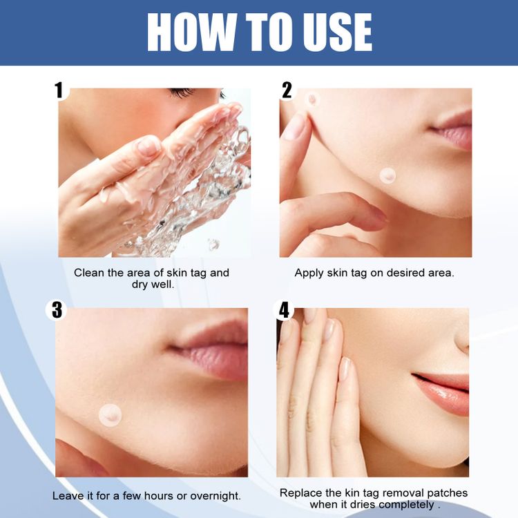 SKIN TAGS PATCHES MOLE & WART REMOVER-ZGD