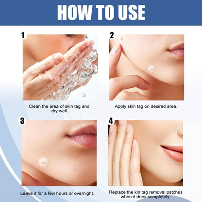 SKIN TAGS PATCHES MOLE & WART REMOVER-ZGD