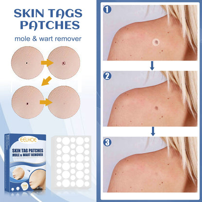 SKIN TAGS PATCHES MOLE & WART REMOVER-ZGD